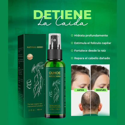 OUHOE tonico crecimiento capilar